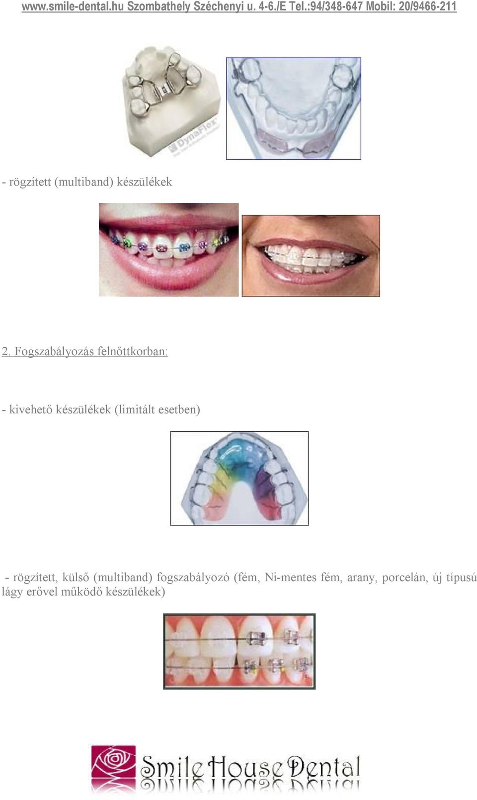 Mi érdekli? Gyermekkori vagy felnőttkori fogszabályozás? Esztétikai  fogászat? Fogékszer? - PDF Free Download