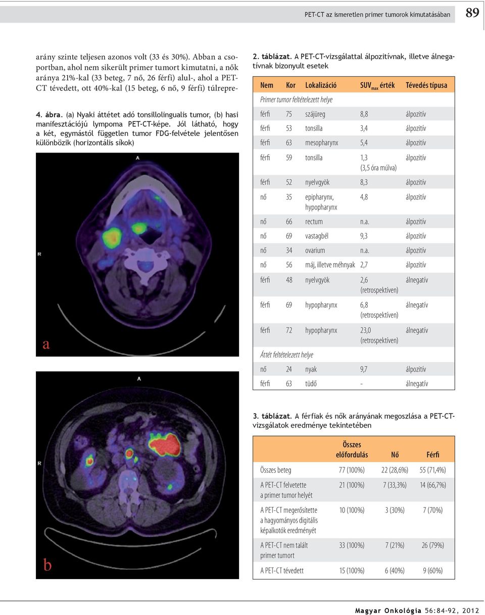 Lokalizáció SUV max érték Tévedés típusa. ábra. (a) Nyaki áttétet adó tonsillolingualis tumor, (b) hasi manifesztációjú lympoma PET-CT-képe.