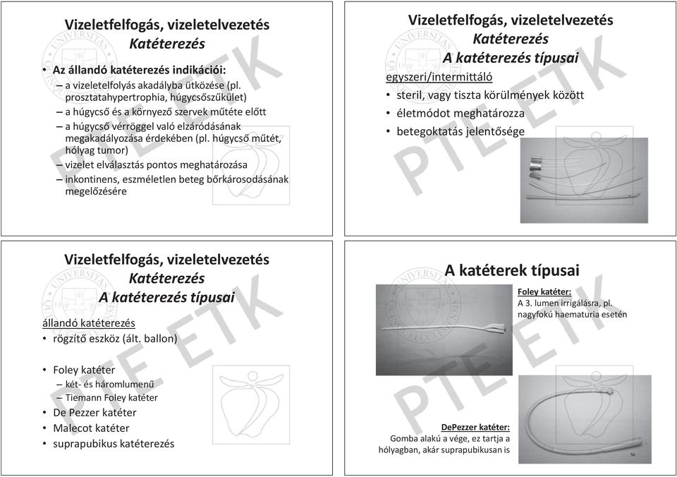 p rosztatahypertrophia, h úgycsƅszƾkkület) prosztatahypertrophia, húgycsƅszƾkület) a húgycsƅ és és a környezƅ környezƅ szervek szerveek mƾtéte mƾtéte elƅtt húgyycsƅ vérröggel vérröggel való elz