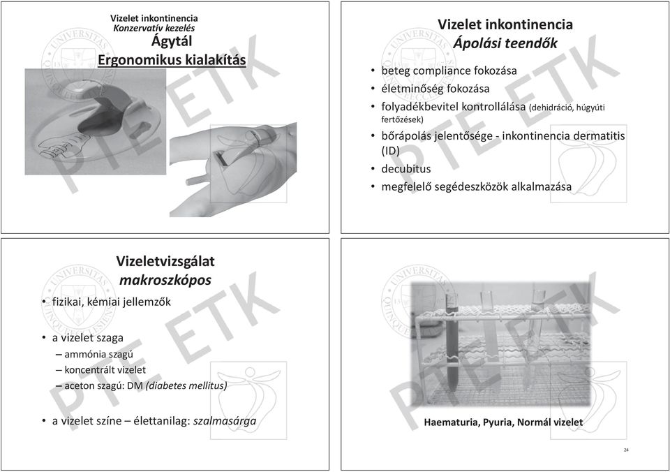 dermatitis (ID) decubitus megfelel segédeszközök alkalmazása makroszkópos fizikai, kémiai jellemz k a vizelet szaga ammónia szagú