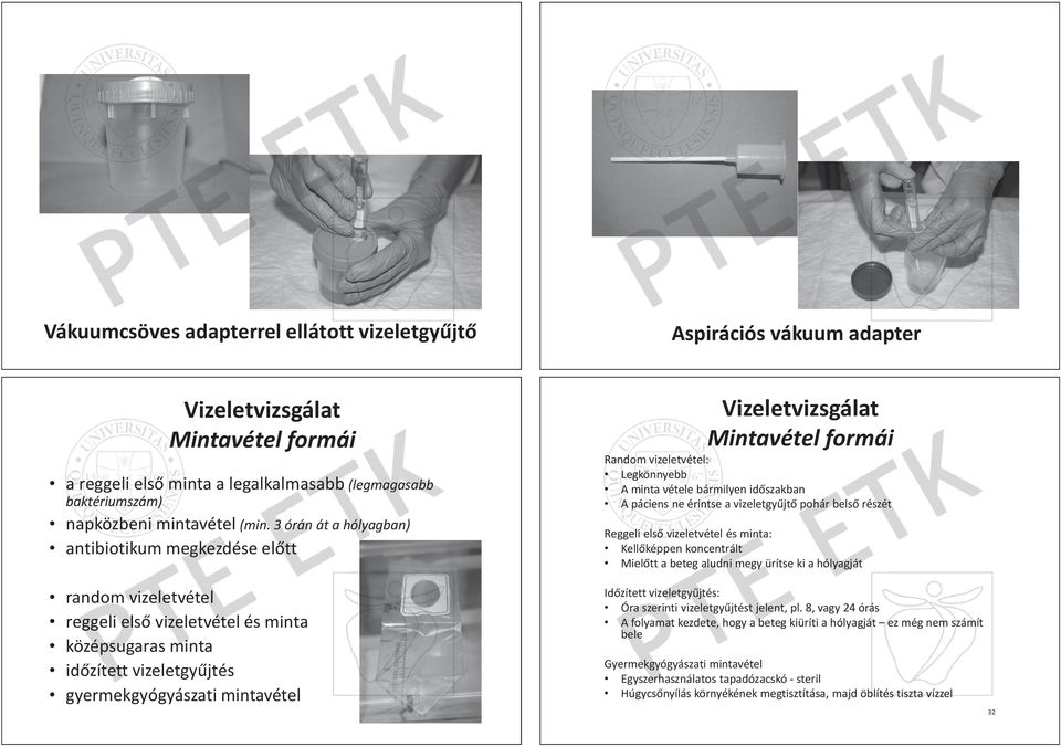 Random vizeletvétel: etvé véte tel: Legkönnyebb nyeb ebb A minta vétele bármilyen id szakban A páciens ne érintse a vizeletgy jt pohár bels részét Reggeli eli els vizeletvétel etvétel és minta: Kell