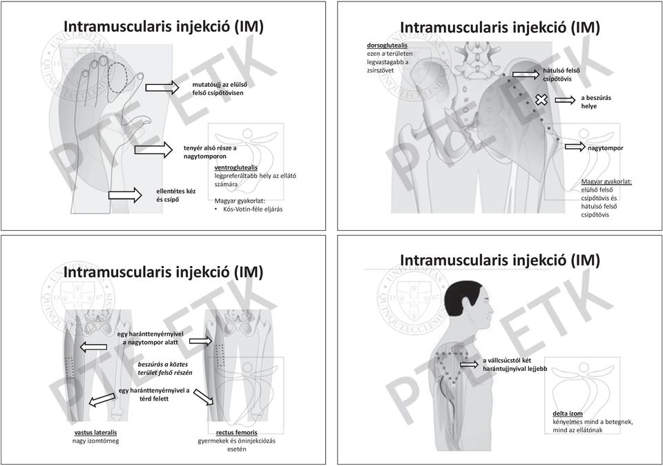 eljárás nagytompor or Magyar ar gyakorlat: elüls fels csíp tövis és hátulsó fels csíp tövis Intramuscularis injekció (IM) Intramuscularis injekció (IM) egy haránttenyérnyivel nyérny nyiv el a