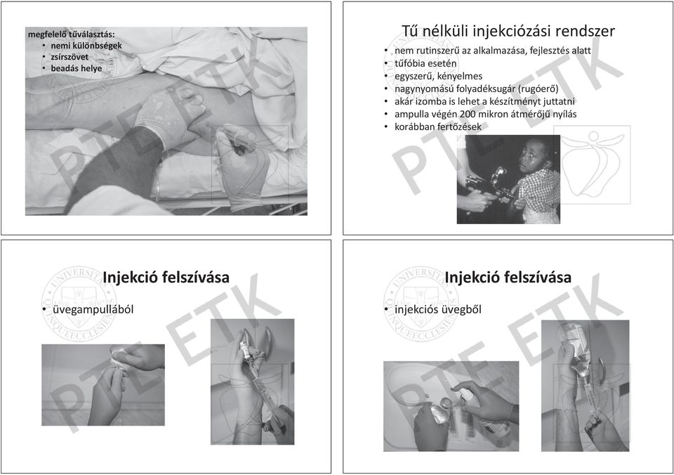 fejlesztéss aalatt latt ƚƾfóbia ƚƾfóbia eesetén setén egyszerƾ, kényelmes egyszerƾ, ké ényelmes nagynyomású folyadéksugár nagynyomású folyadéksugá ár ((rugóerƅ) ruggóerƅ) akár lehet készítményt ak