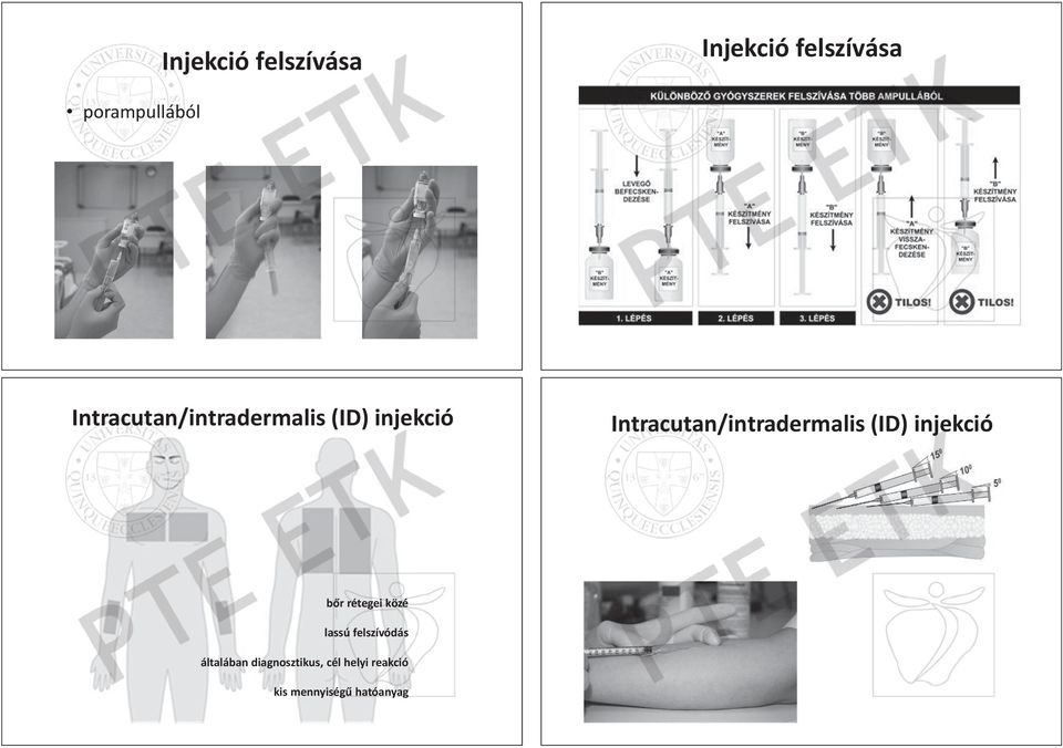 lassú általában diagnosztikus, cél él helyi hel elyi el yi rea eakc ea kció kc ió reakció mennyiségƾ hatóanyag kis