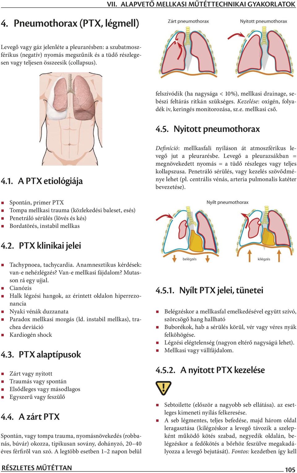 felszívódik (ha nagysága < 10%), mellkasi drainage, sebészi feltárás ritkán szükséges. Kezelése: oxigén, folyadék iv, keringés monitorozása, sz.e. mellkasi cső. 4.5. Nyitott pneumothorax 4.1. A PTX etiológiája Definíció: mellkasfali nyíláson át atmoszférikus levegő jut a pleurarésbe.