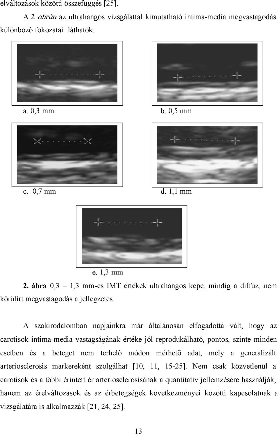 A szakirodalomban napjainkra már általánosan elfogadottá vált, hogy az carotisok intima-media vastagságának értéke jól reprodukálható, pontos, szinte minden esetben és a beteget nem terhelõ módon