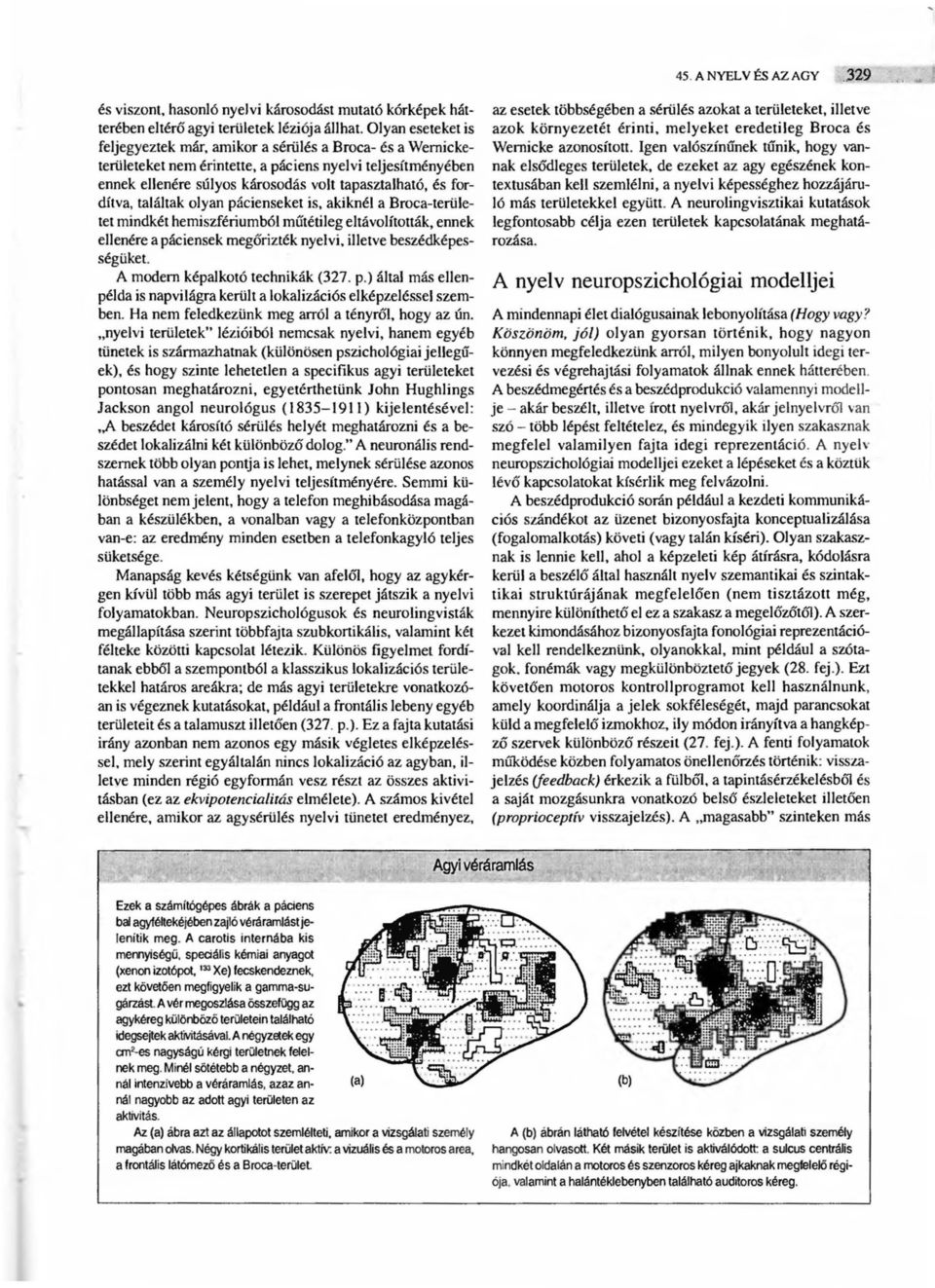 a páciens nyelvi teljesítményében ennek ellenére súlyos károsodás volt tapasztalható, és fordítva, találtak olyan pácienseket is, akiknél a Broca-területet mindkét hemiszfériumból