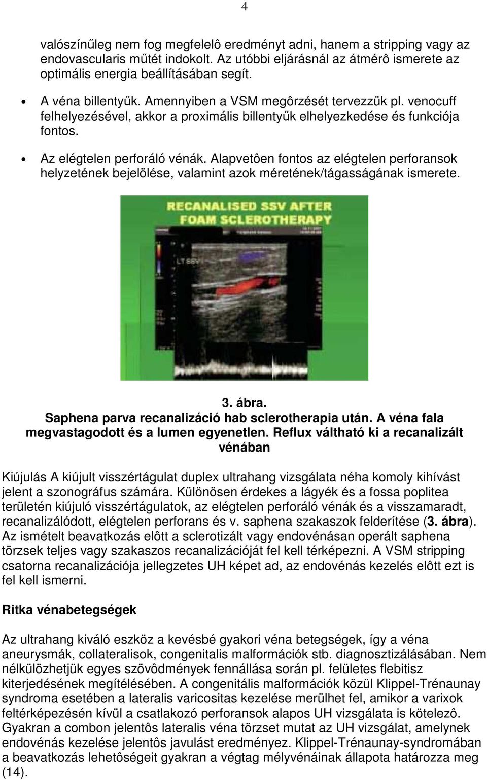 Alapvetôen fontos az elégtelen perforansok helyzetének bejelölése, valamint azok méretének/tágasságának ismerete. 3. ábra. Saphena parva recanalizáció hab sclerotherapia után.