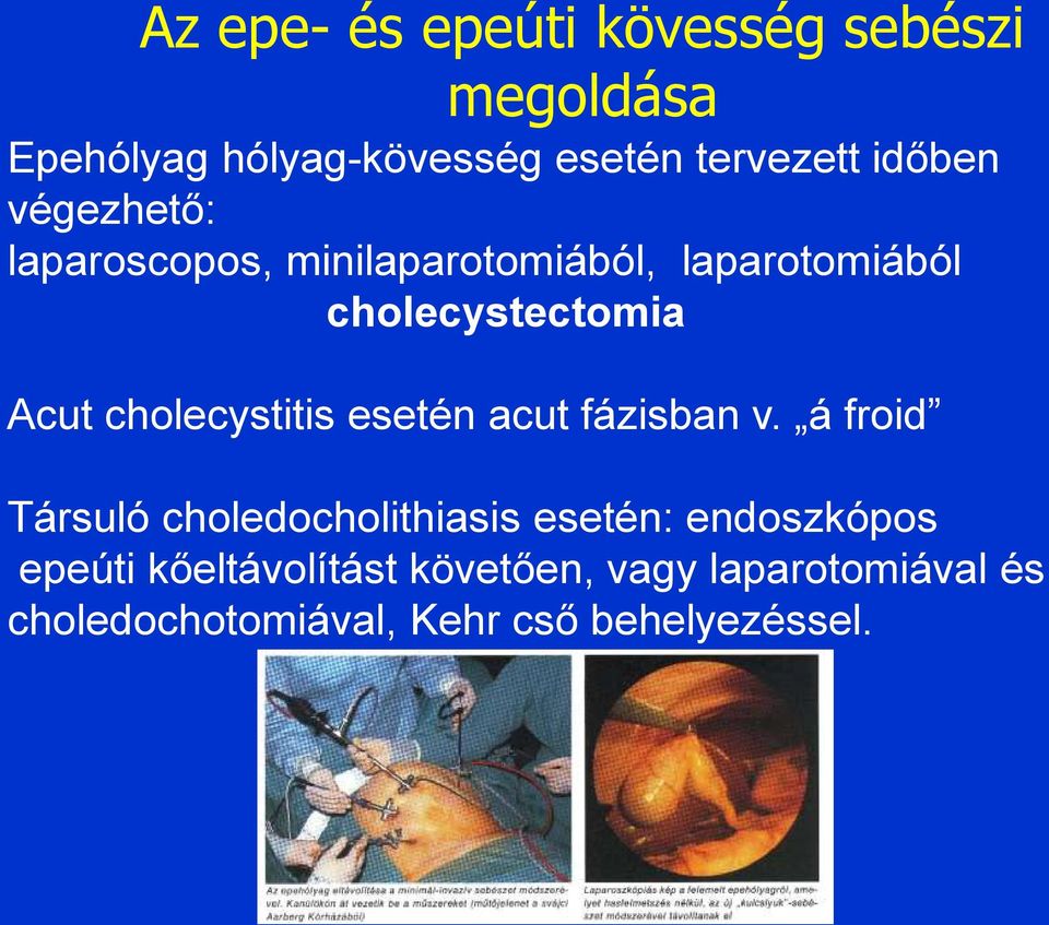 cholecystitis esetén acut fázisban v.