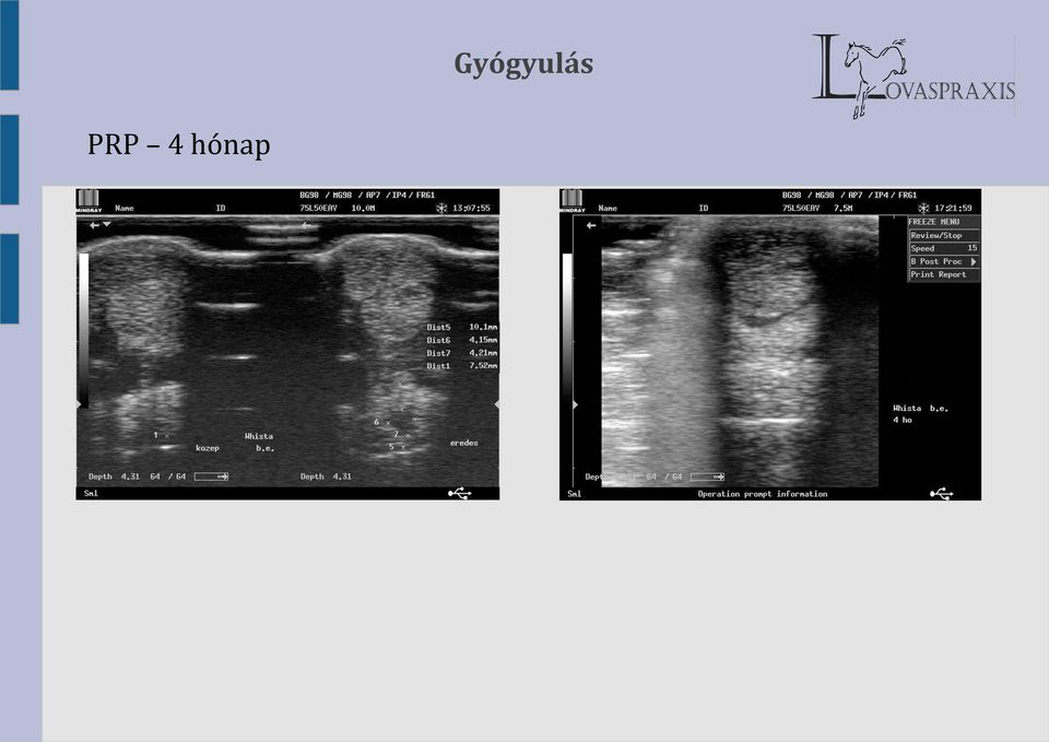 Gyógyulás