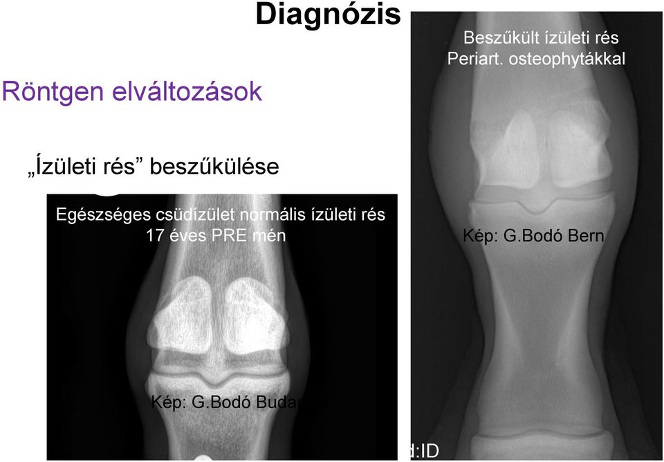 osteophytákkal Ízületi rés beszűkülése Egészséges