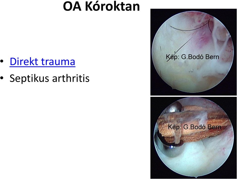 arthritis Kép: G.