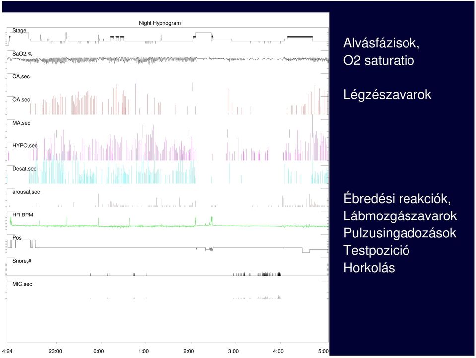 HR,BPM Pos Snore,# MIC,sec Ébredési reakciók, Lábmozgászavarok