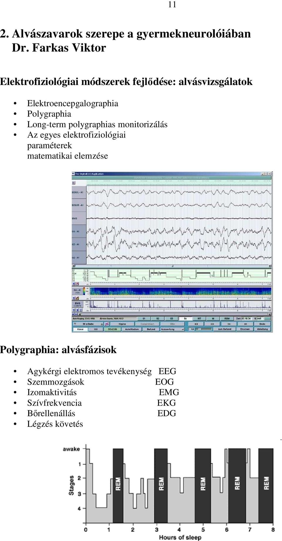 Polygraphia Long-term polygraphias monitorizálás Az egyes elektrofiziológiai paraméterek matematikai