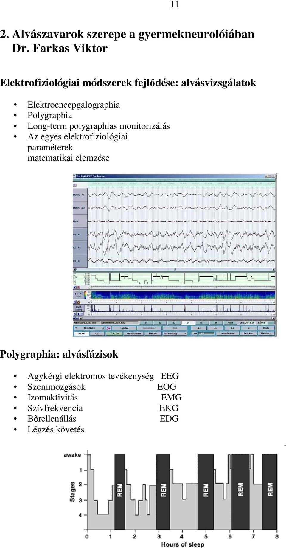 Polygraphia Long-term polygraphias monitorizálás Az egyes elektrofiziológiai paraméterek matematikai