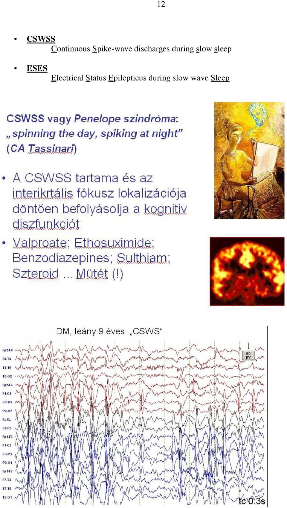 slow sleep ESES Electrical