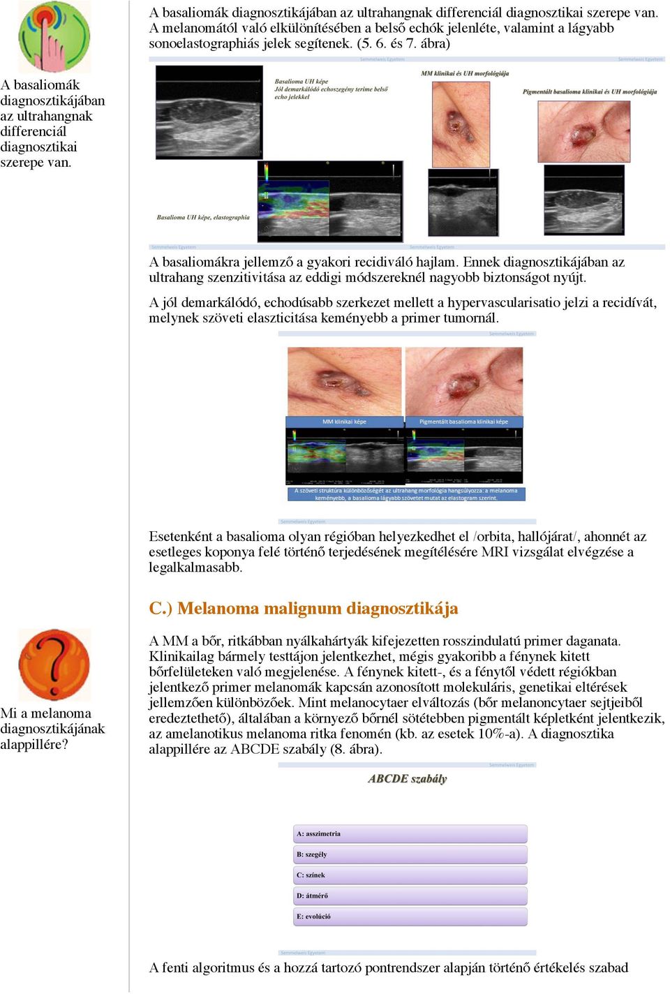 Ennek diagnosztikájában az ultrahang szenzitivitása az eddigi módszereknél nagyobb biztonságot nyújt.