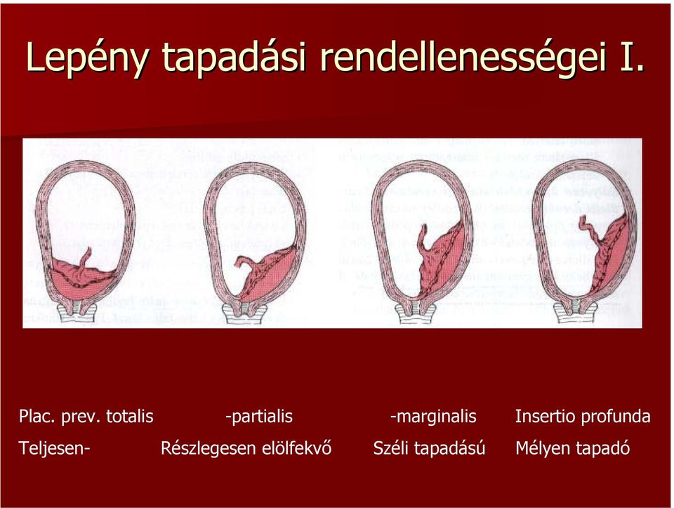 totalis -partialis -marginalis Insertio