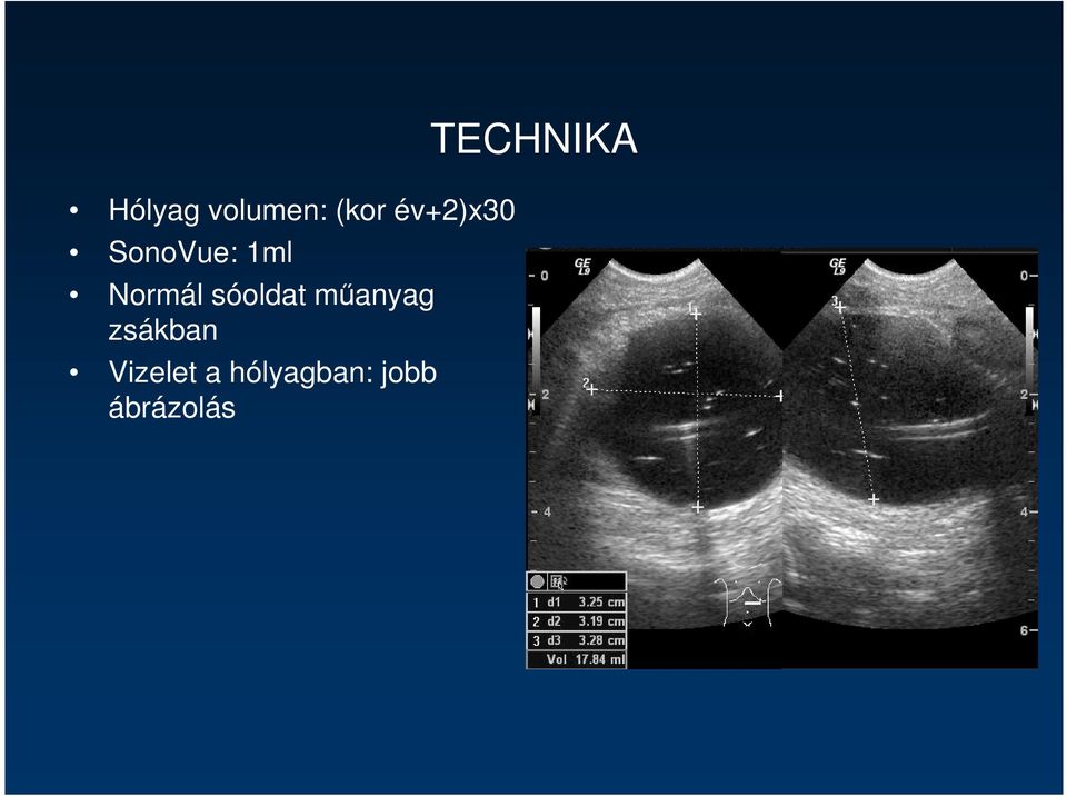 mőanyag zsákban Vizelet a