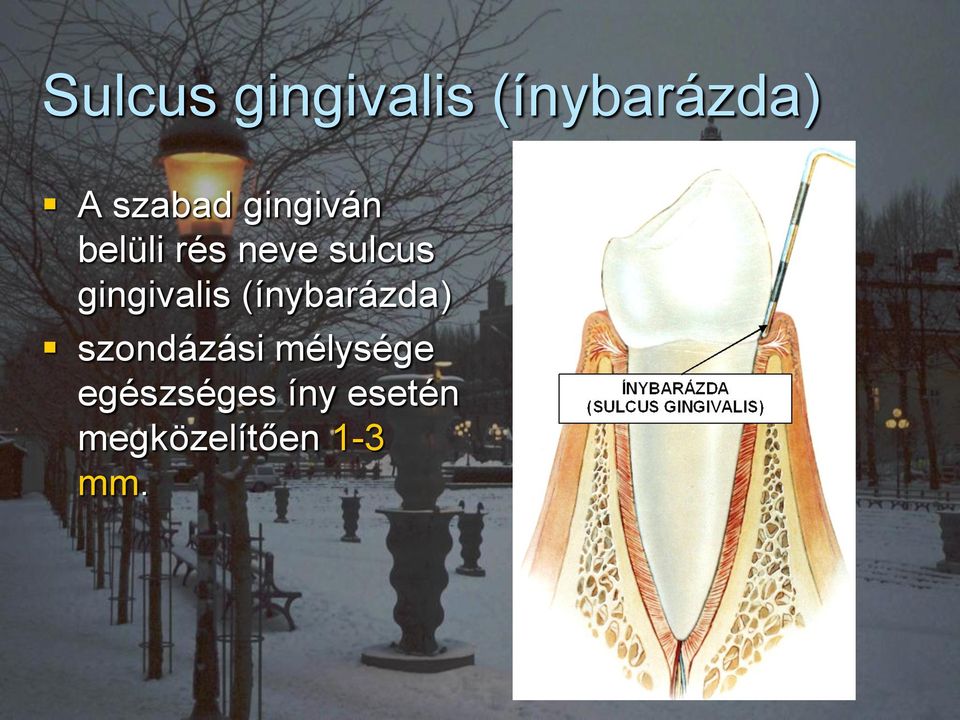 gingivalis (ínybarázda) szondázási