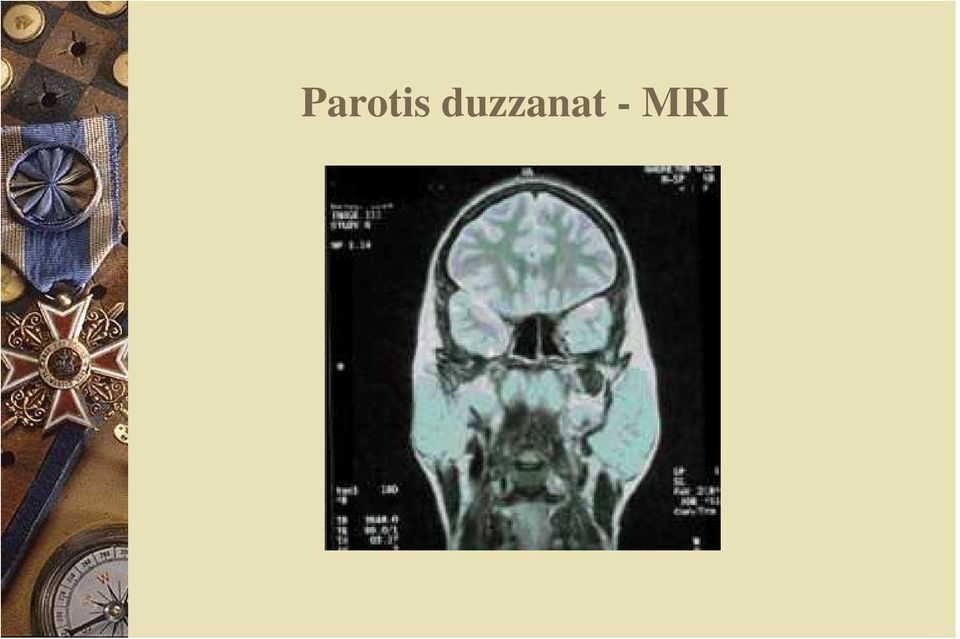 - MRI