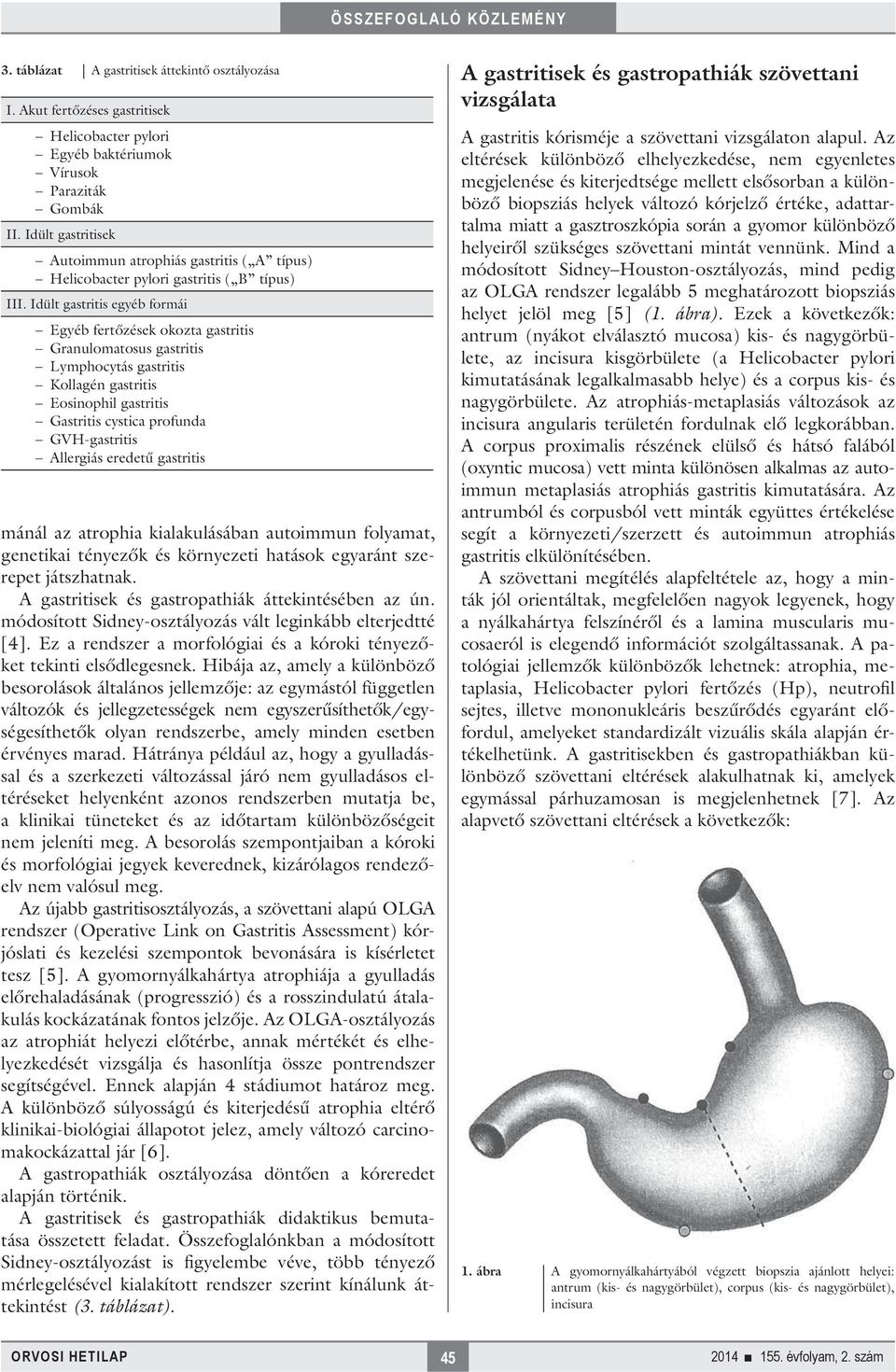 Idült gastritis egyéb formái Egyéb fertőzések okozta gastritis Granulomatosus gastritis Lymphocytás gastritis Kollagén gastritis Eosinophil gastritis Gastritis cystica profunda GVH-gastritis