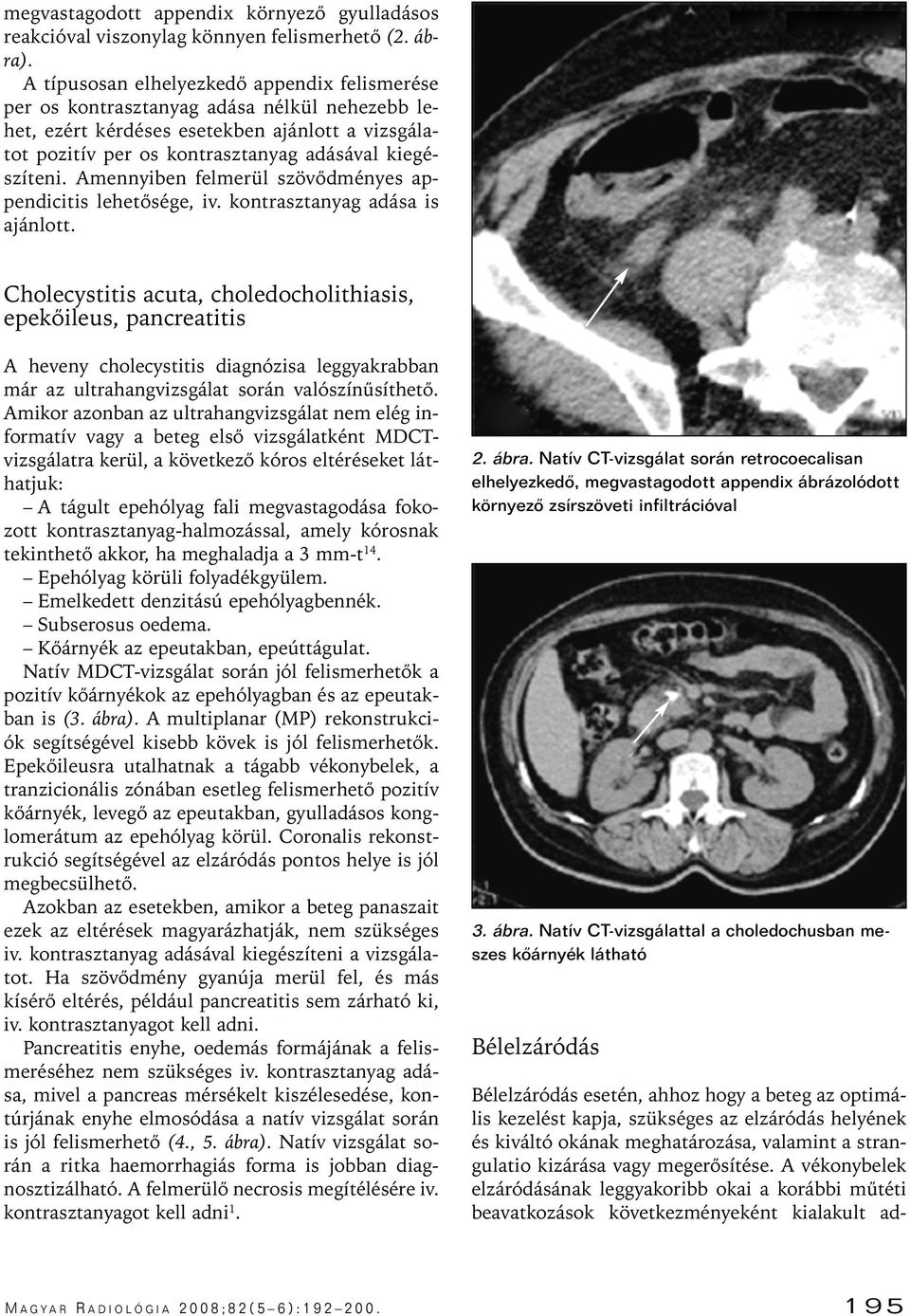 Amennyiben felmerül szövôdményes appendicitis lehetôsége, iv. kontrasztanyag adása is ajánlott.