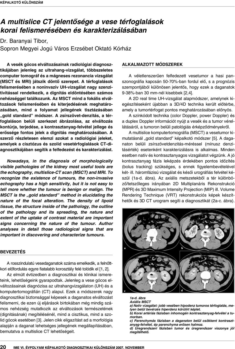 mágneses rezonancia vizsgálat (MSCT és MRI) játszik döntô szerepet.