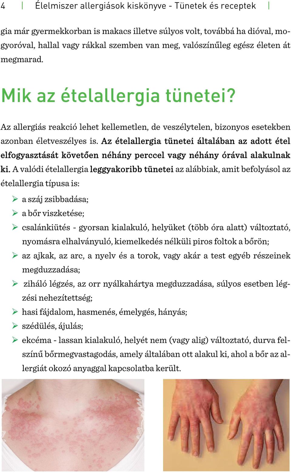 Az ételallergia tünetei általában az adott étel elfogyasztását követően néhány perccel vagy néhány órával alakulnak ki.