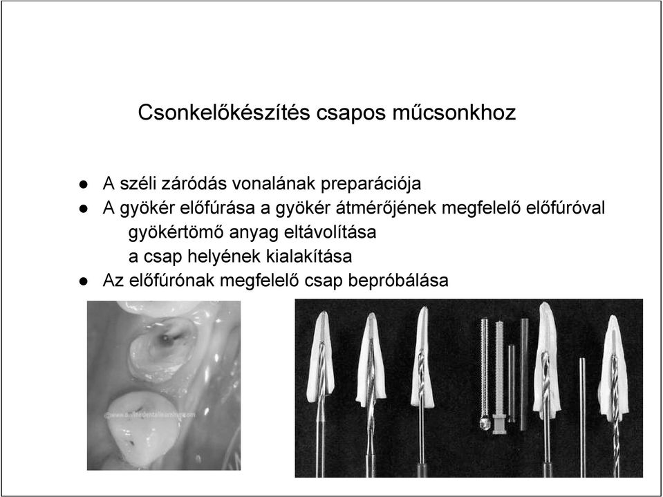 átmérőjének megfelelő előfúróval gyökértömő anyag