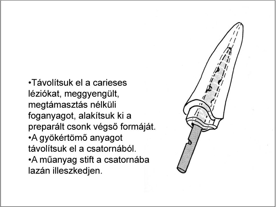 preparált csonk végső formáját.