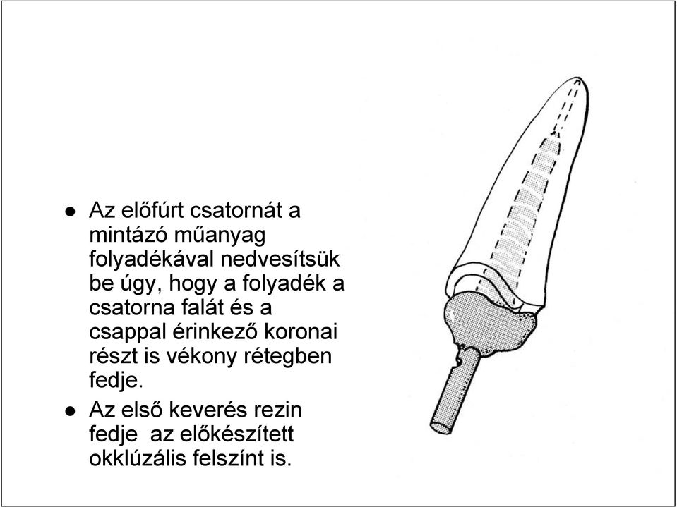 csappal érinkező koronai részt is vékony rétegben fedje.