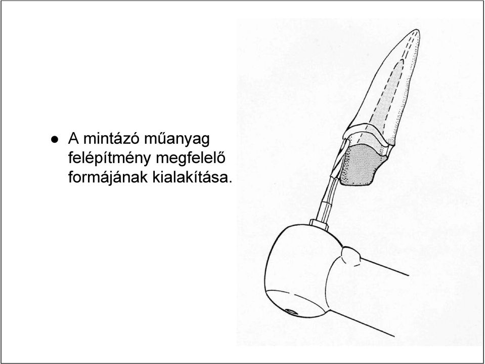 felépítmény
