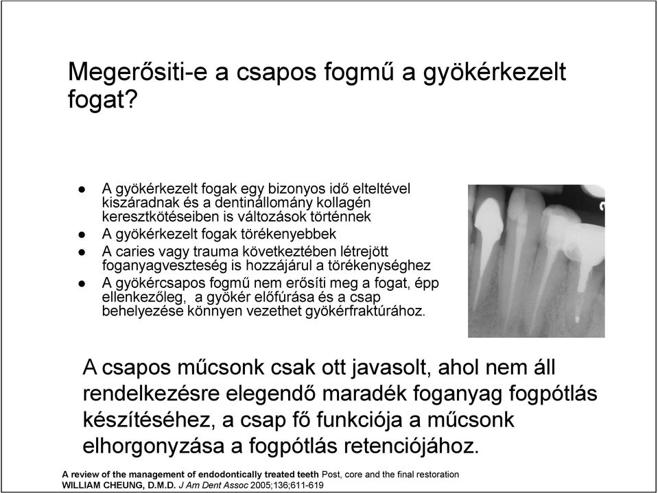 következtében létrejött foganyagveszteség is hozzájárul a törékenységhez A gyökércsapos fogmű nem erősíti meg a fogat, épp ellenkezőleg, a gyökér előfúrása és a csap behelyezése könnyen vezethet