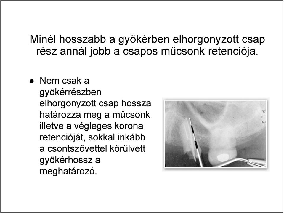 Nem csak a gyökérrészben elhorgonyzott csap hossza határozza meg a