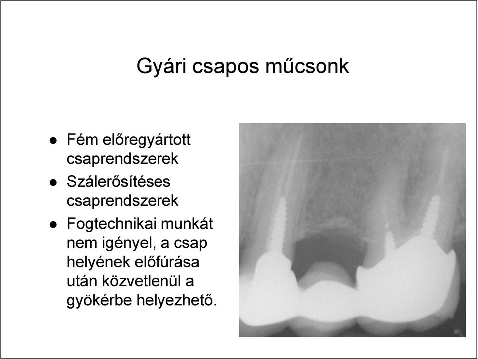 Fogtechnikai munkát nem igényel, a csap