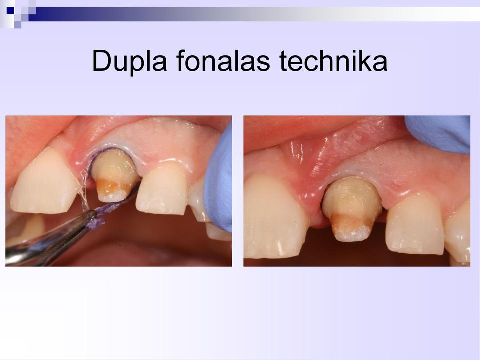 technika