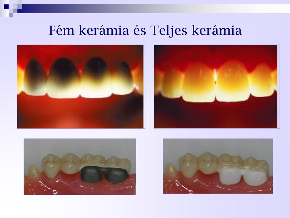 és Teljes