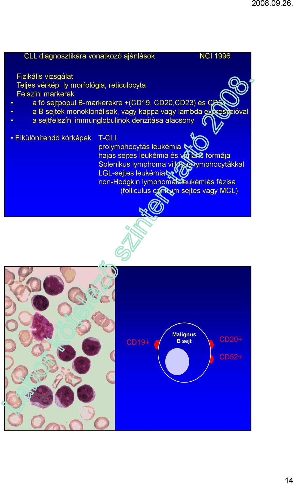 b-markerekre +(CD19, CD20,CD23) és CD5+ a B sejtek monoklonálisak, vagy kappa vagy lambda expresszióval a sejtfelszíni immunglobulinok