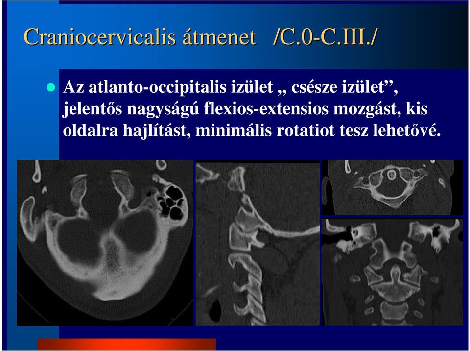 / Az atlanto-occipitalis izület csésze izület,