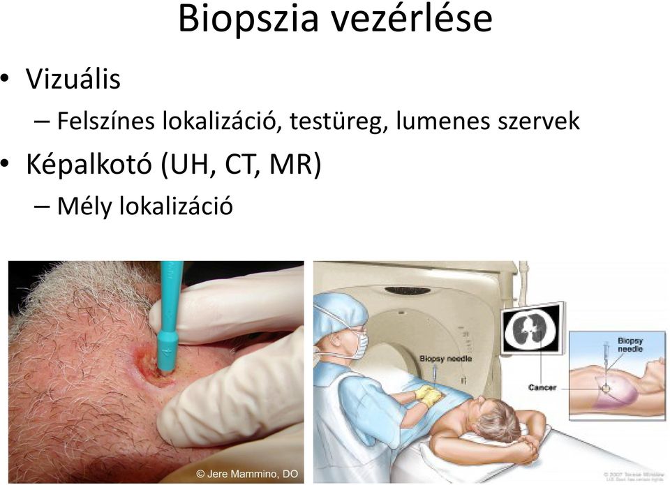 testüreg, lumenes szervek