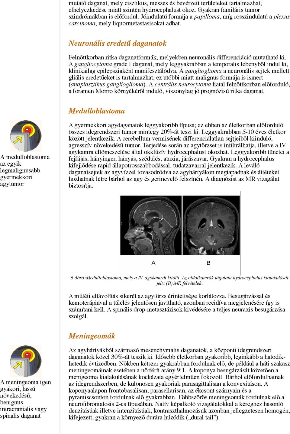 Neuronális eredetű daganatok Felnőttkorban ritka daganatformák, melyekben neuronális differenciáció mutatható ki.