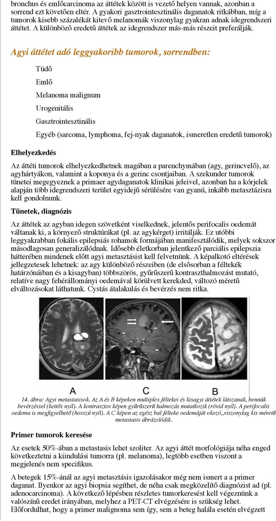 A különböző eredetű áttétek az idegrendszer más-más részeit preferálják.