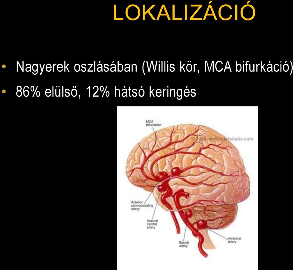 kör, MCA bifurkáció)