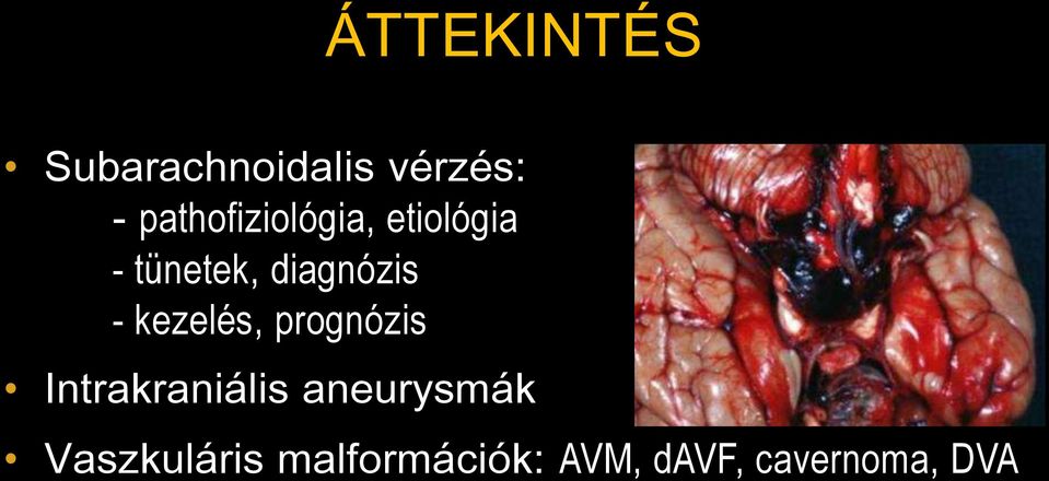 diagnózis - kezelés, prognózis Intrakraniális