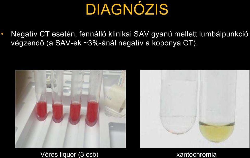 végzendő (a SAV-ek ~3%-ánál negatív a