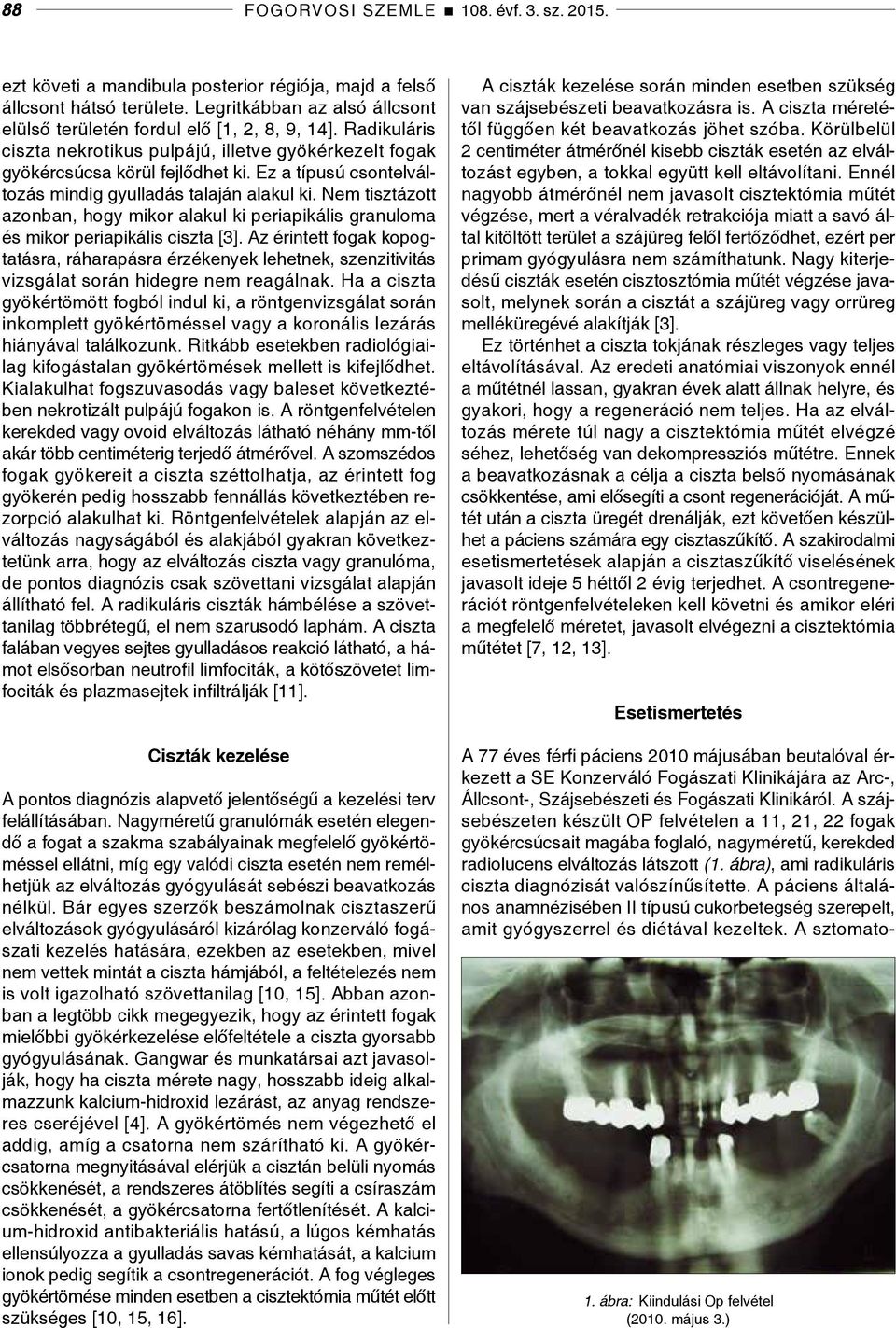 Nem tisztázott azonban, hogy mikor alakul ki periapikális granuloma és mikor periapikális ciszta [3].