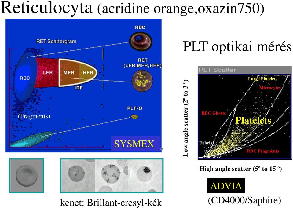 Debris Large Platelets Microcytes Platelets RBC Fragments High