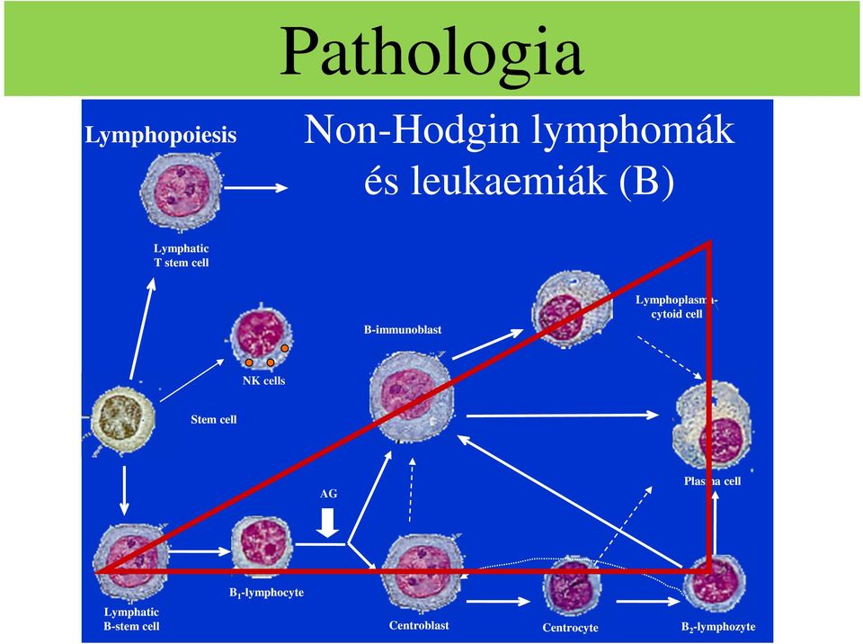 B-immunoblast Lymphoplasmacytoid cell NK cells Stem cell AG