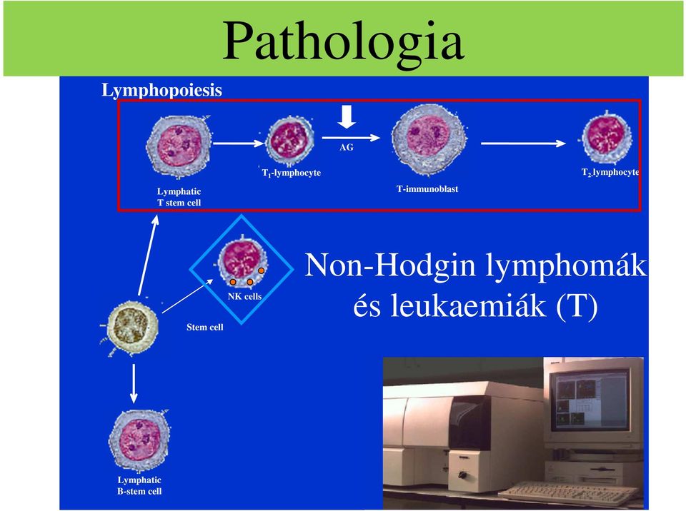 2- lymphocyte Stem cell NK cells Non-Hodgin